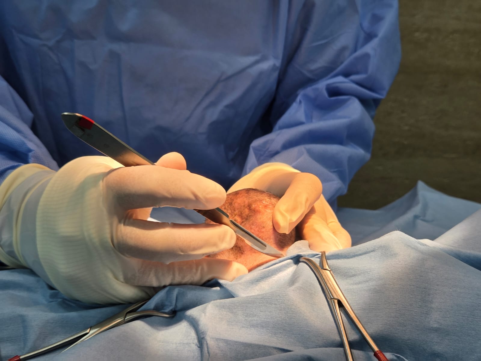 Huge lump on dog being surgically removed at Gaia Vets by Dr Arman Chen.jpeg