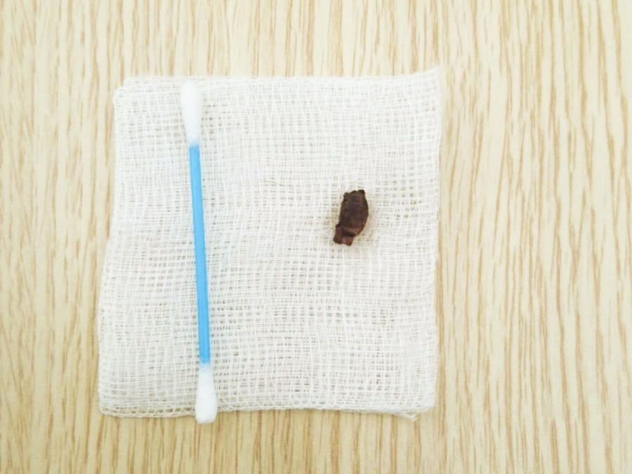 Improper use of cotton buds in pets.jpg