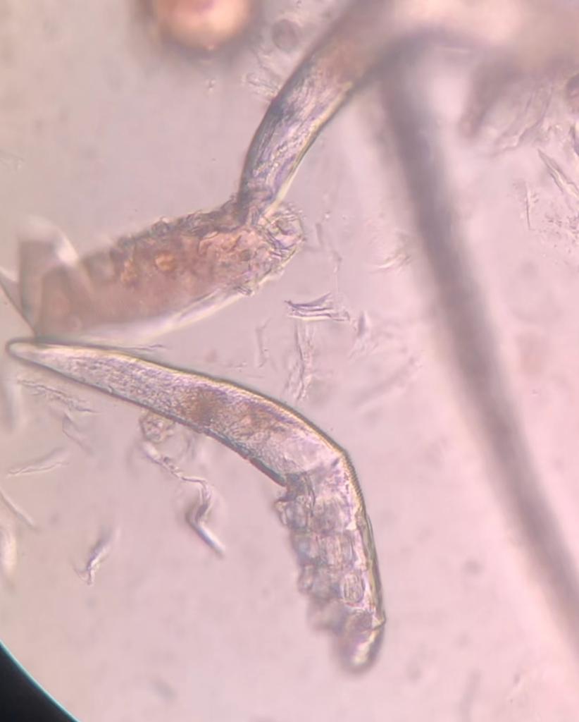 Demodex mites can feed in dog hair follicles and proliferate, causing problems.